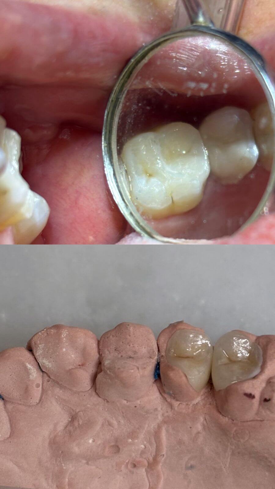 Trabalho clínico de prótese dentária